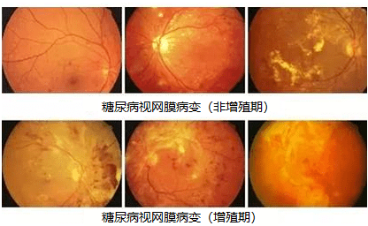 补硒补多了会出现什么症状