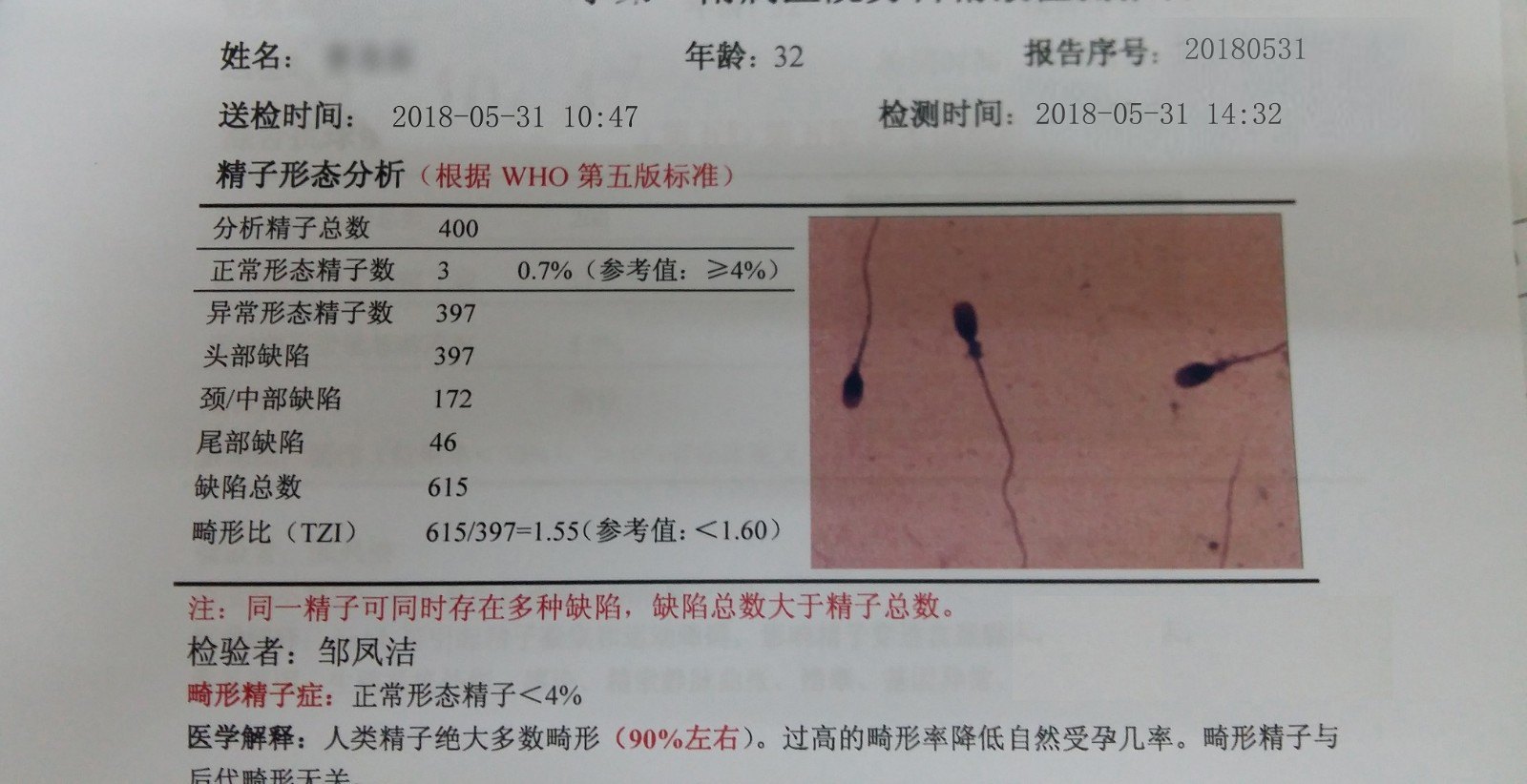 吃什么补锌补硒