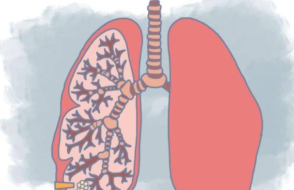 肺结节能补充硒元素吗