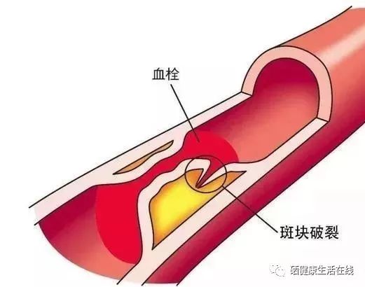 补硒后身体有调节反应