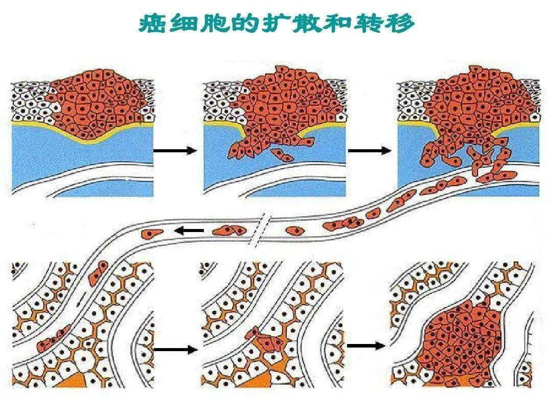 任何肿瘤都要补硒吗吗