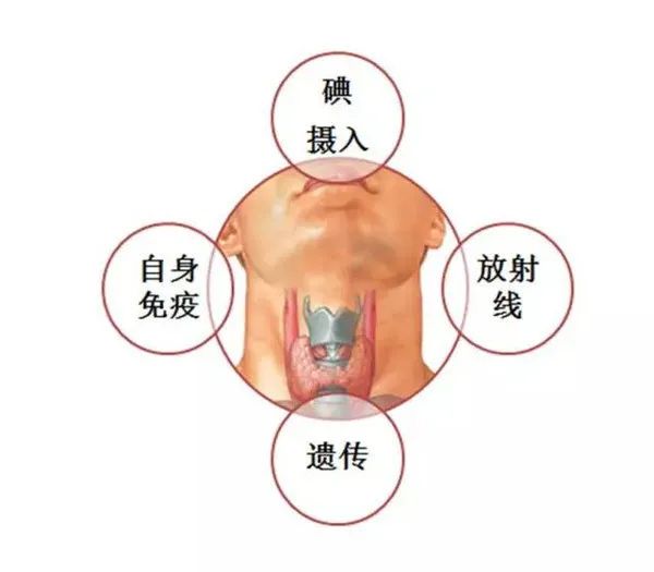 甲状腺肿要补碘还是硒