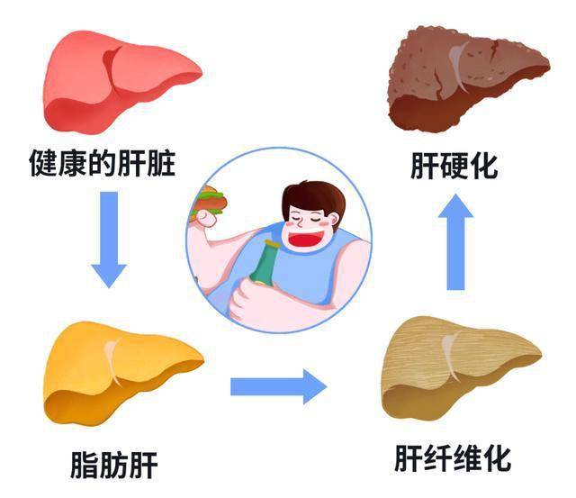 脂肪肝能否补硒元素硒