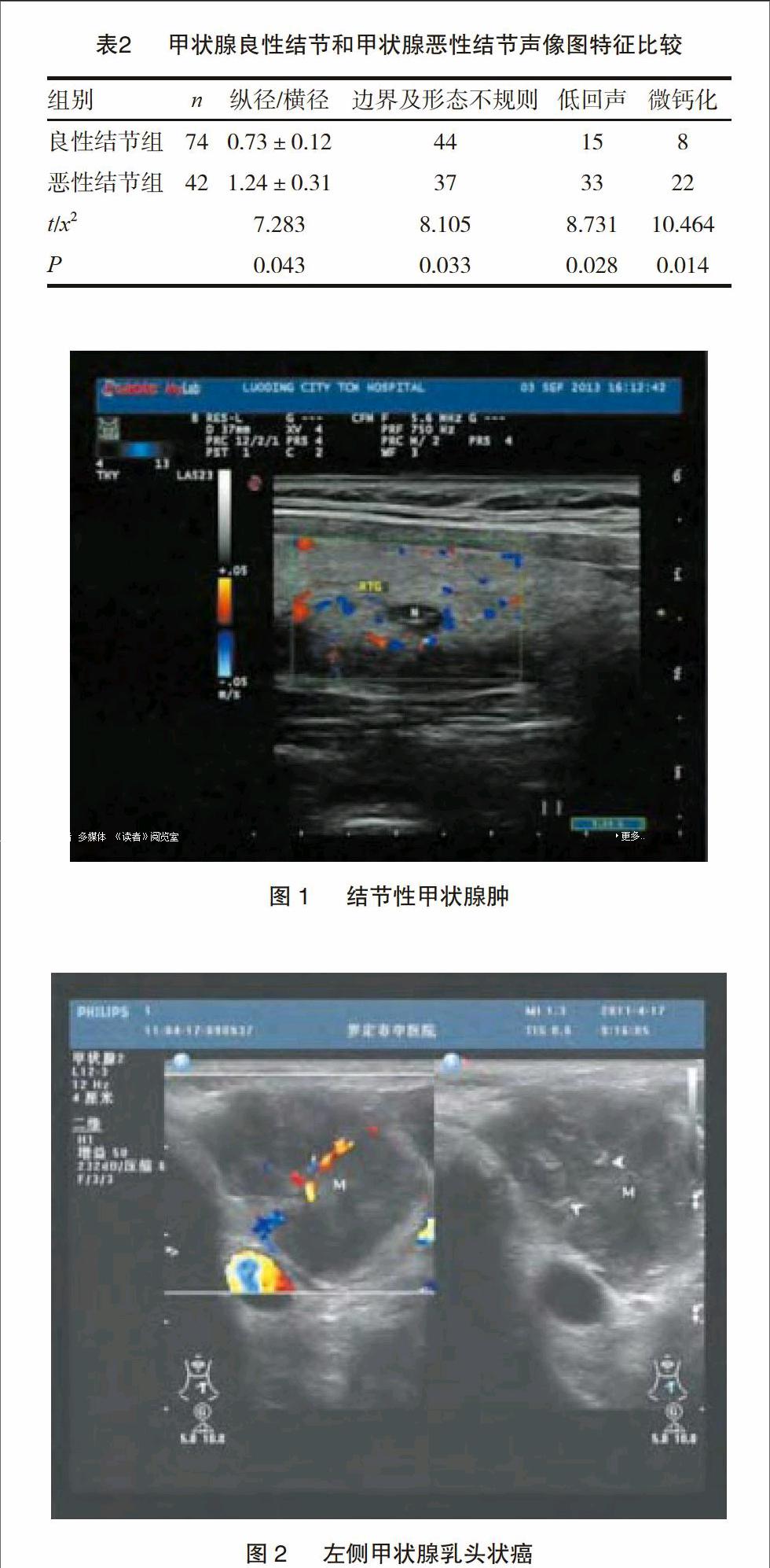 甲状腺切除可以补硒吗