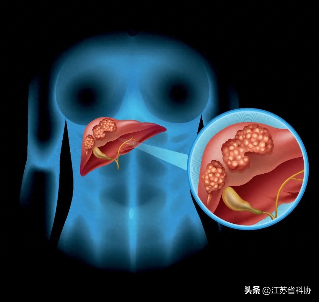 肝病补硒还是吃护肝片