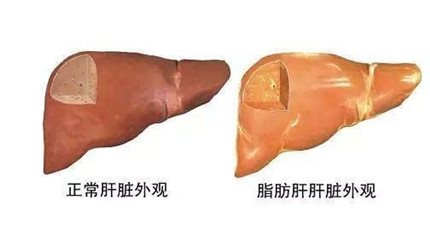 肝病补硒还是吃护肝片