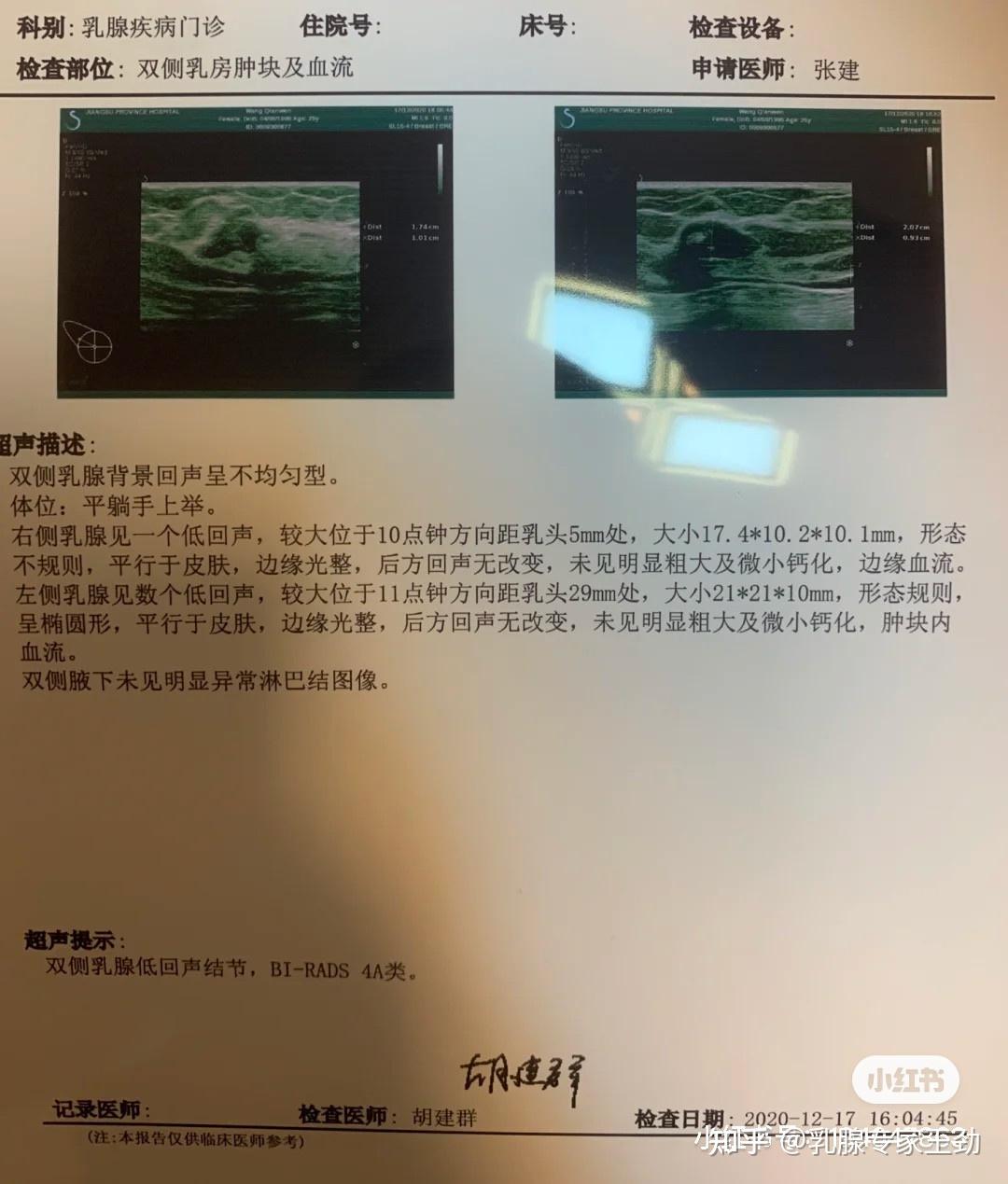 乳腺小叶增生怎么补硒