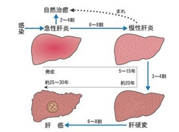 补硒过量导致肝部不适