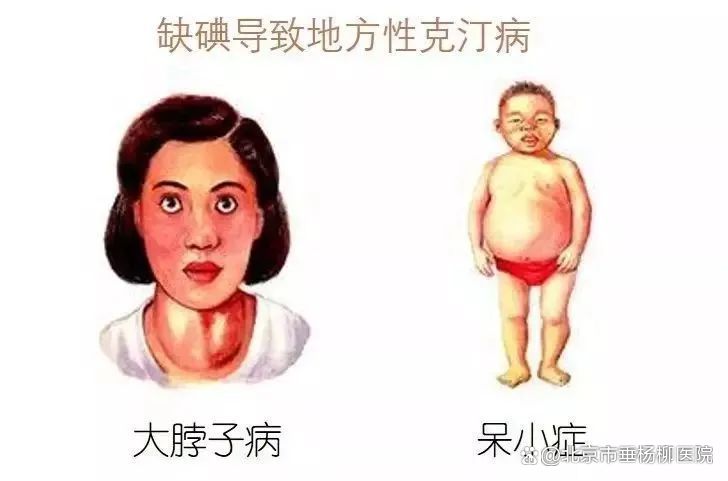 补硒会得甲状腺结节吗