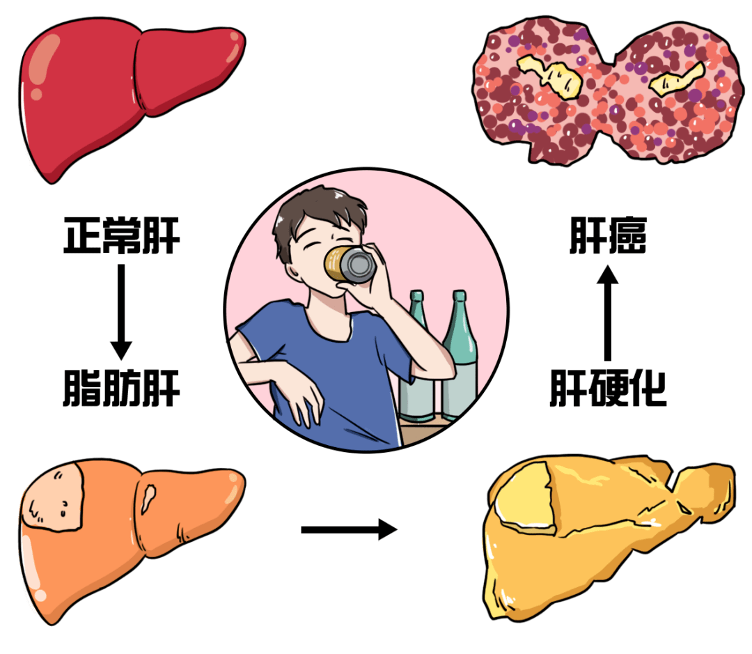 胃癌化疗期间补硒食物