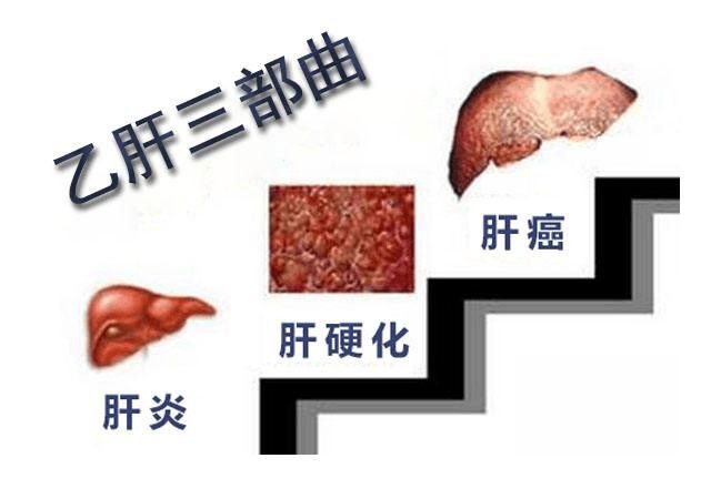 甲状腺癌每日补硒多少