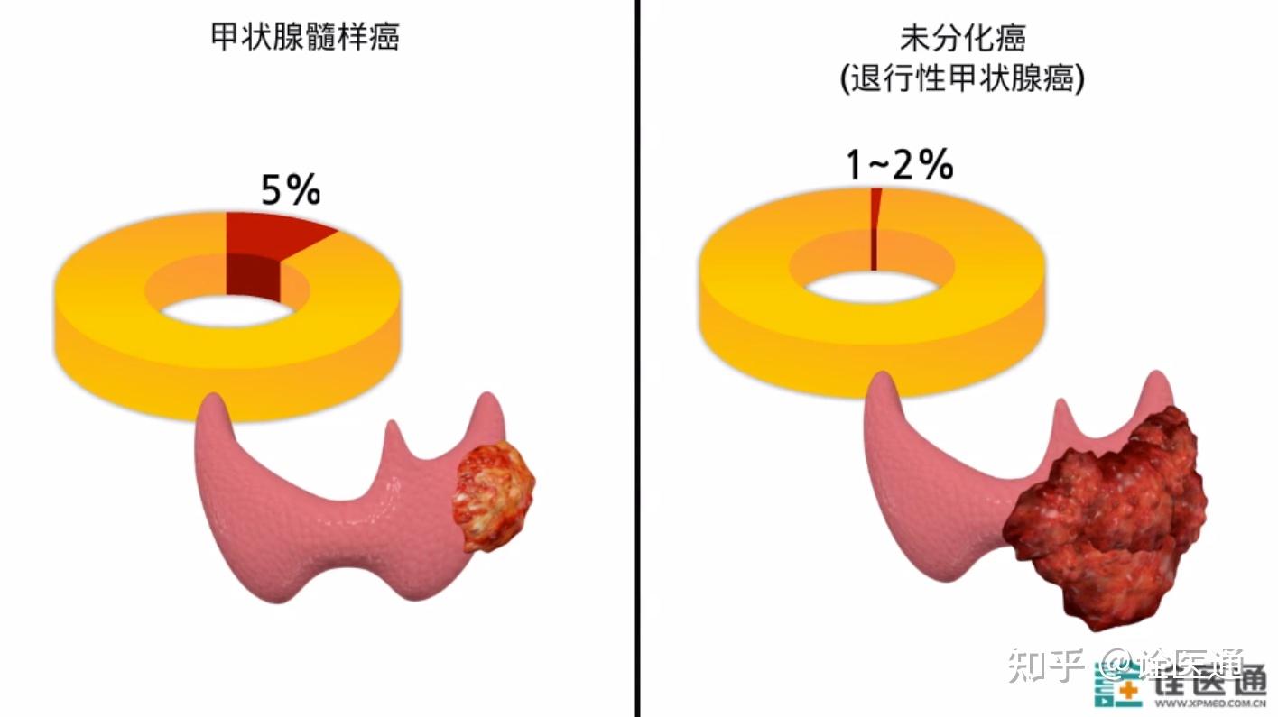 甲状腺癌术后怎么补硒