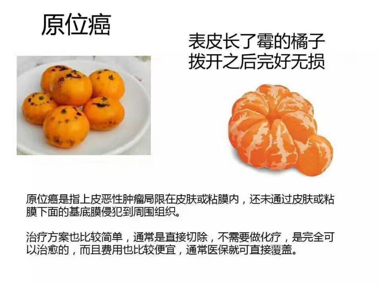 原位癌术后需要补硒吗