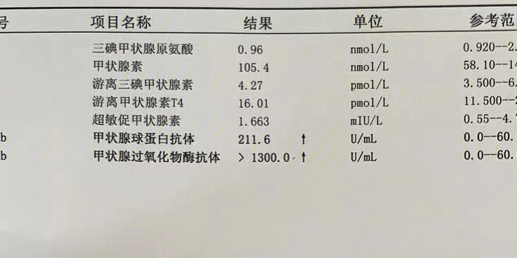 甲亢桥本病可以补硒吗