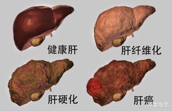 补硒会加重肝脏负担吗