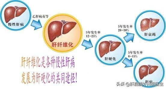 补硒会加重肝脏负担吗