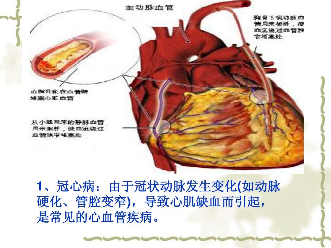 心脏病人补硒那种产品