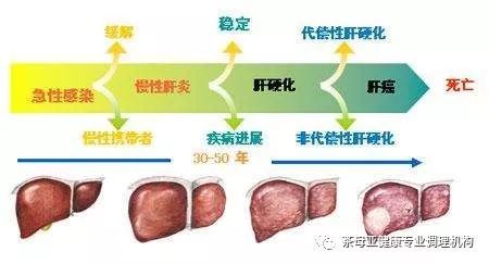 补硒乙肝患者怎么选择