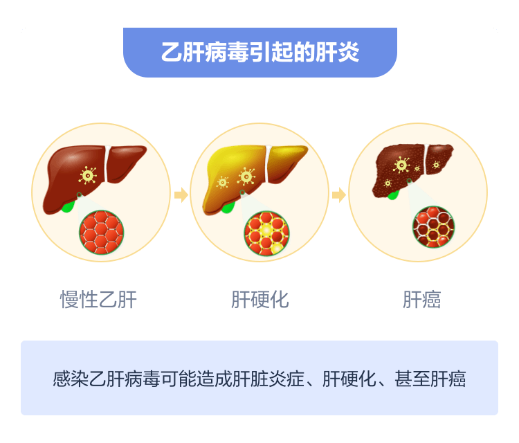 乙肝肝硬化怎么补硒好