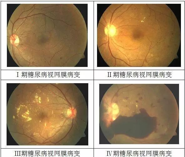 癌症患者补硒吃什么药