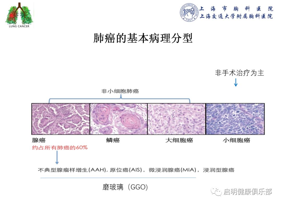 哪些恶性肿瘤不可补硒