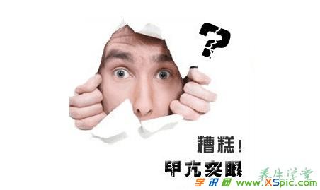 患了甲亢突眼怎么办_甲亢突眼怎么治疗