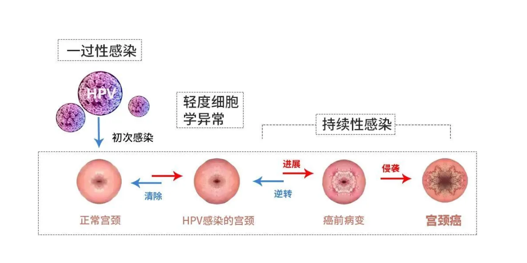 治疗hpv补硒有用吗