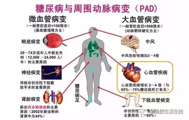 天天补硒能否治脑血栓