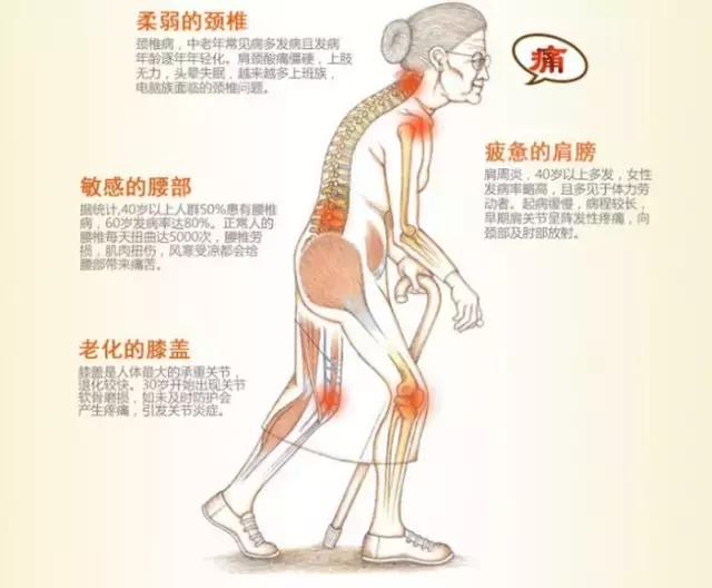 全面详细介绍骨关节疾病的症状、病因、治疗等情况，看这篇就够了