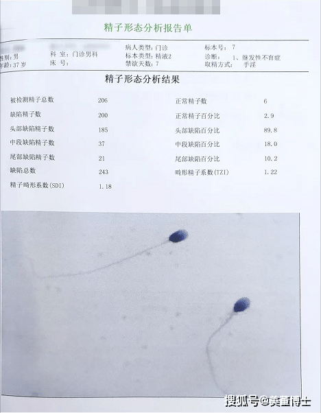 孕前检查医生叫我补硒