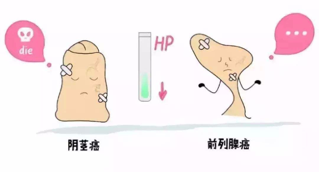 哪种补硒的能治hpv