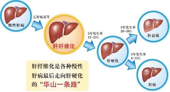 乙肝病人如何合理补硒