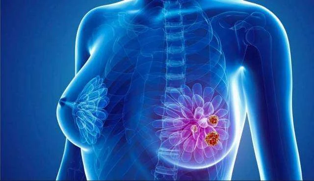 宫颈癌患者补硒的方法