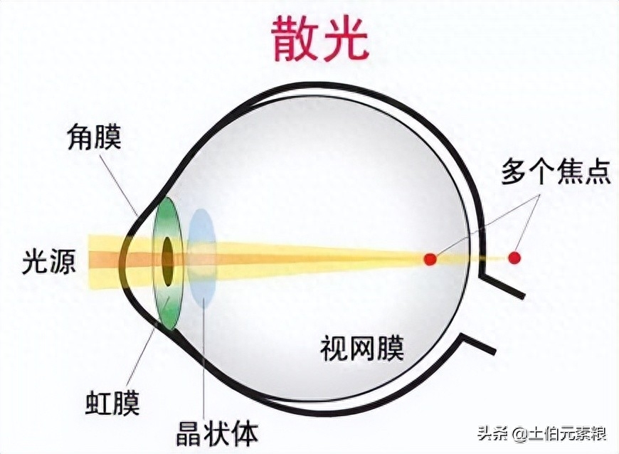 什么东西补硒