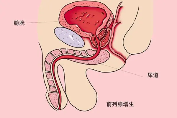 成年男人补硒