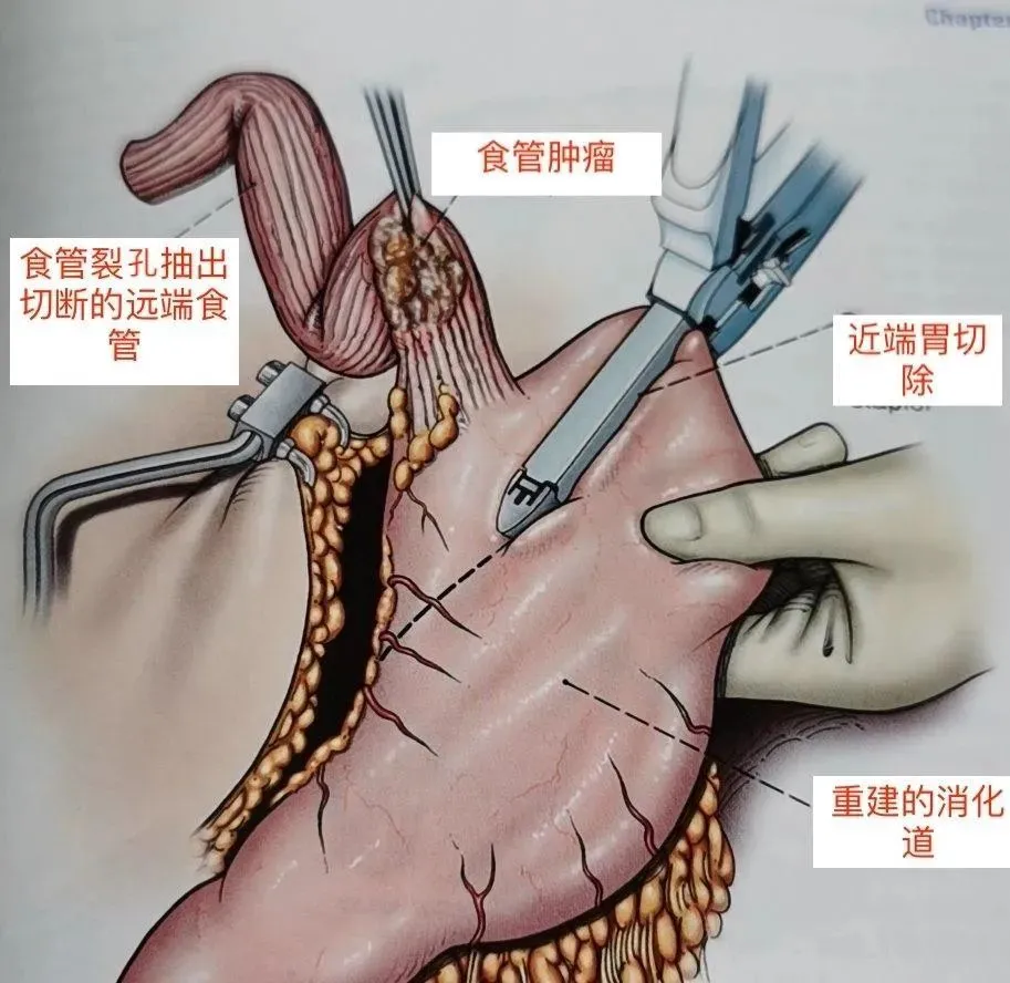 活检病变补硒