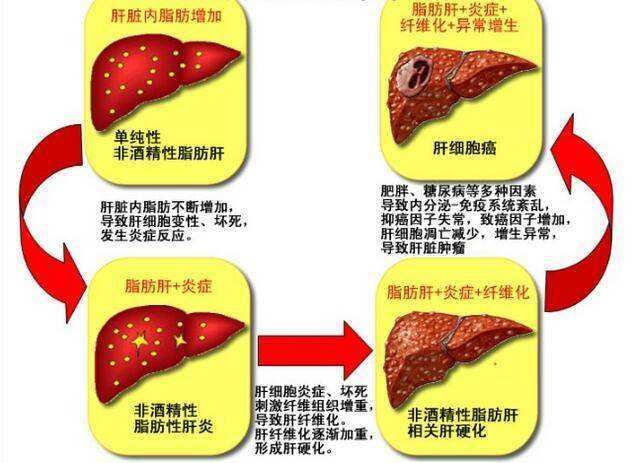 肝病如何补硒