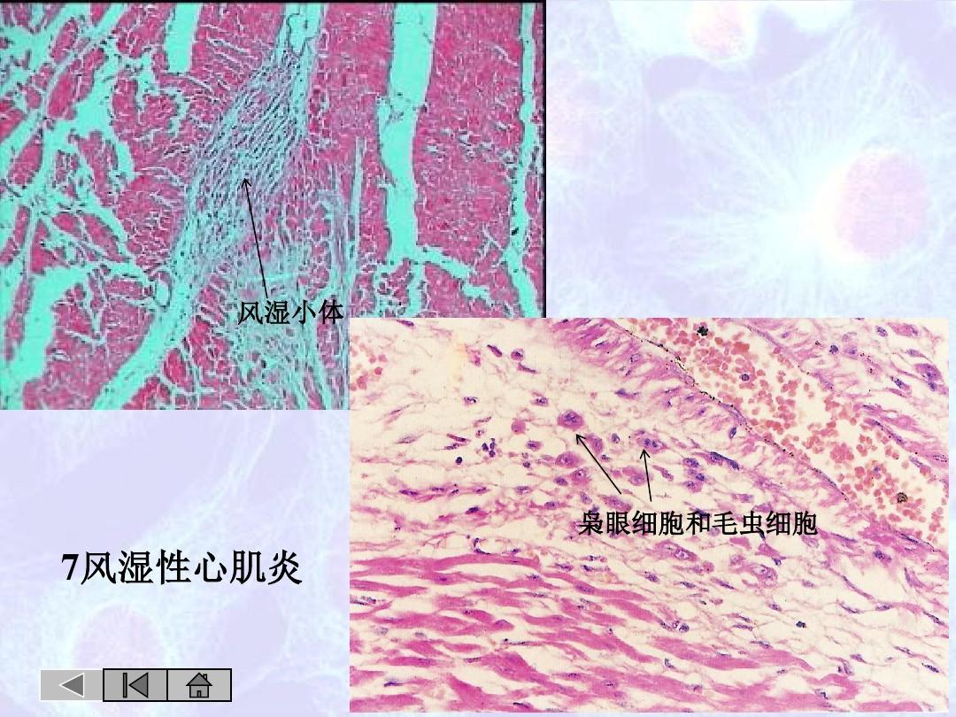 补硒对抗炎症