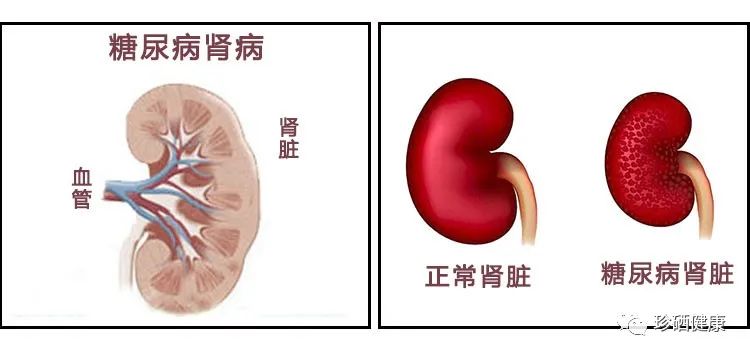 皮肤瘙痒补硒