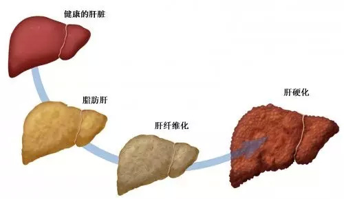 补硒要禁酒吗