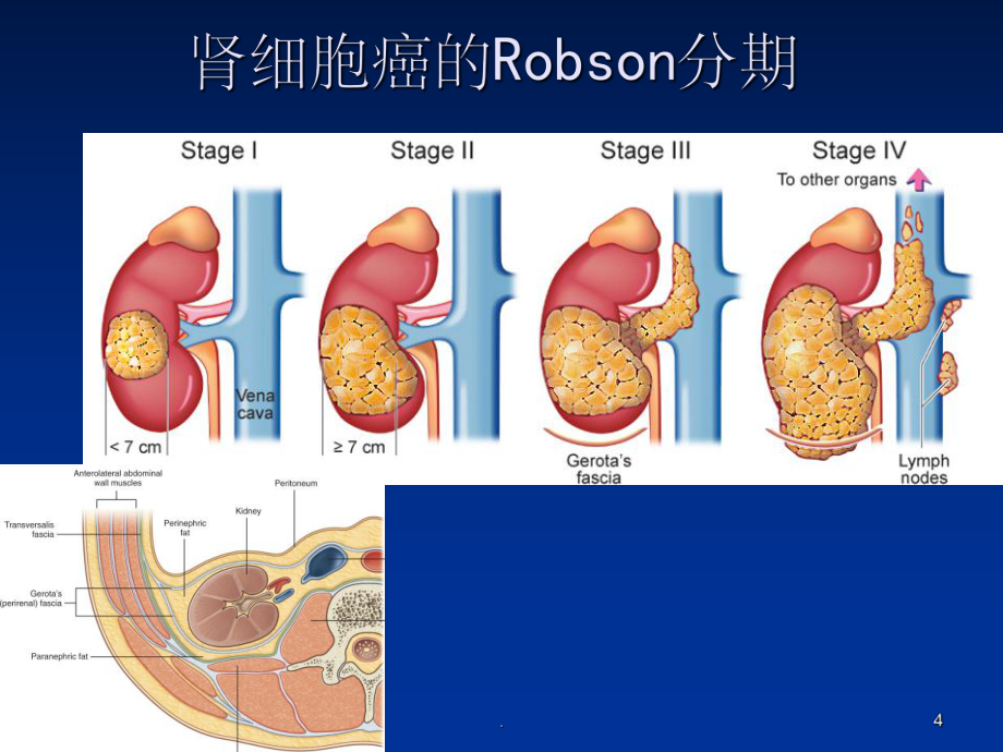 肾肿瘤补硒量