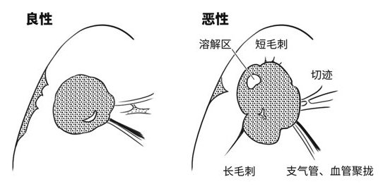 医生说要补硒