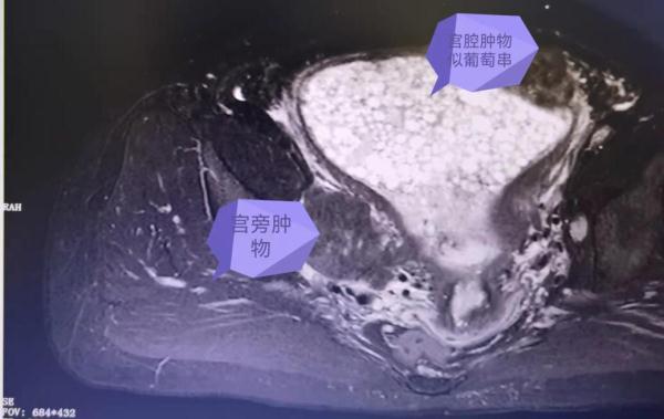 补硒会耳鸣吗