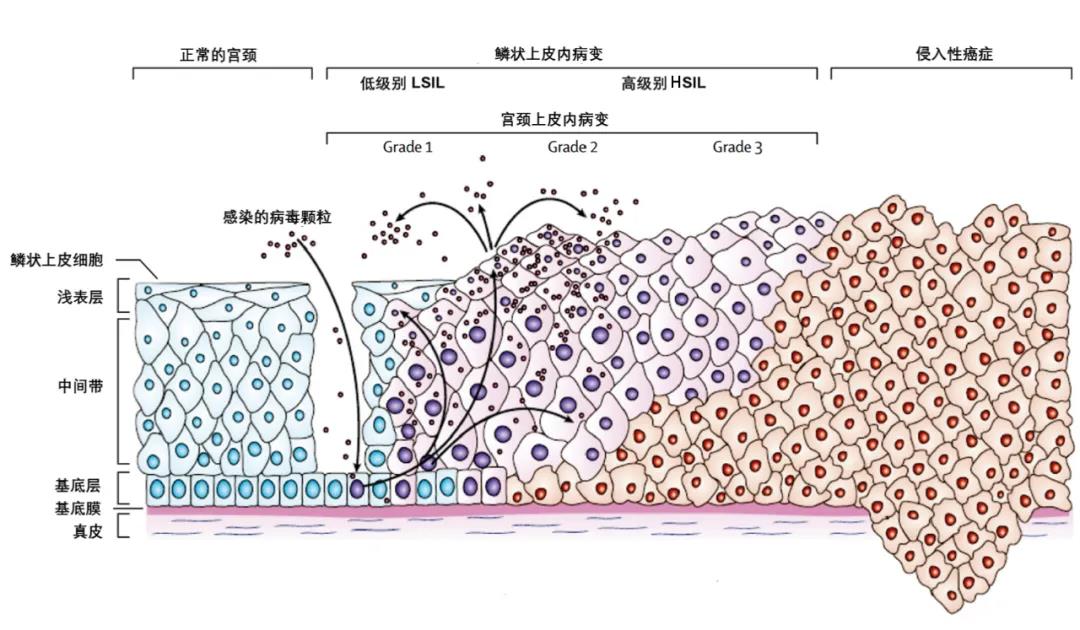 补硒阴道出血