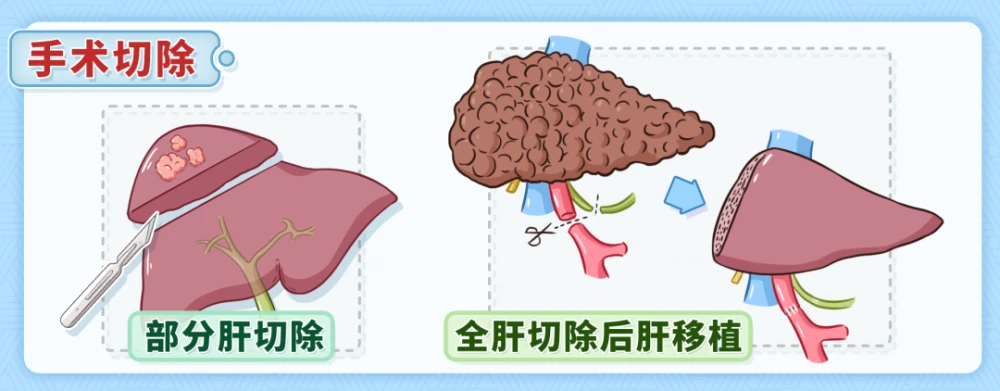 补硒睡觉手麻