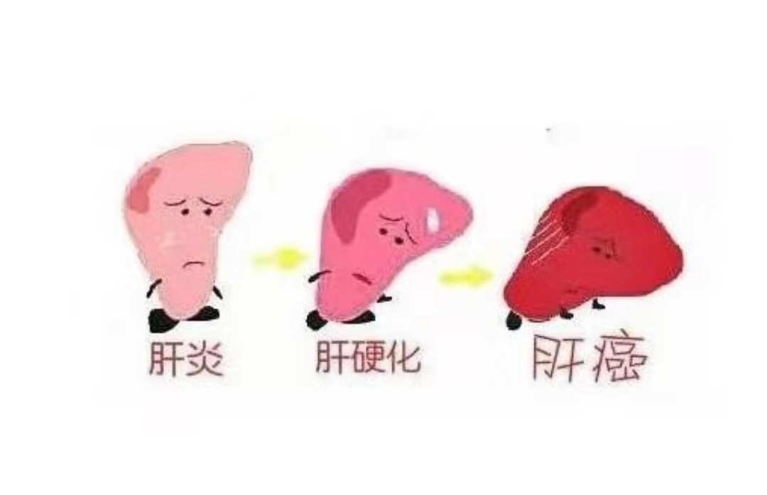 补硒能防肝癌