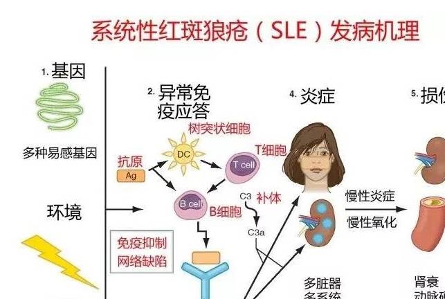 红斑狼疮补硒