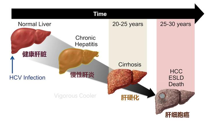 补硒后肝区疼