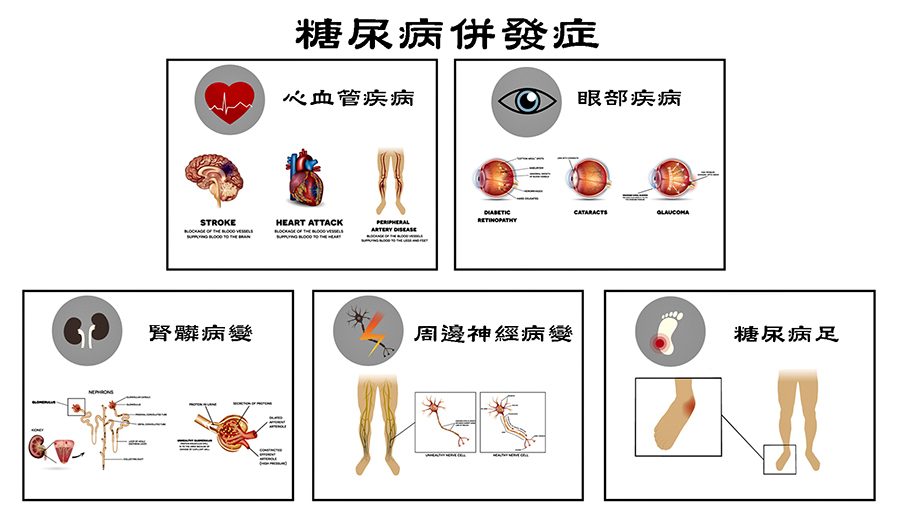 补硒治糖尿病