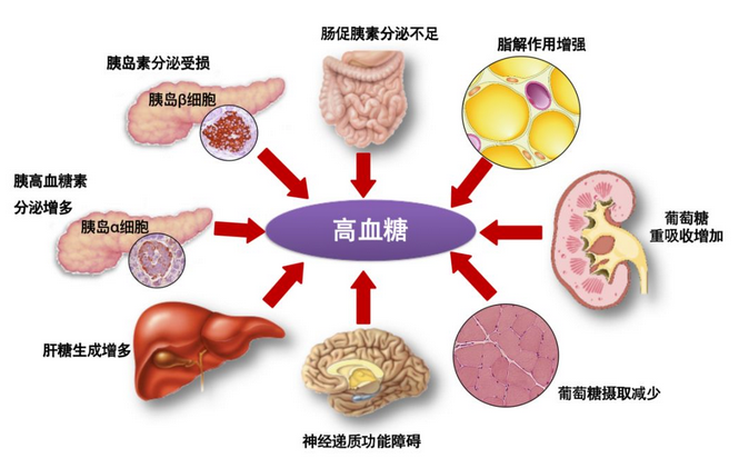 补硒治糖尿病